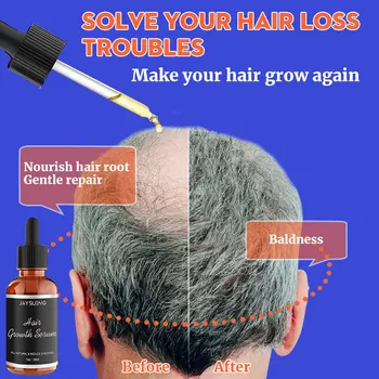 Жидкая сыворотка для восстановления роста волос, эффективная против выпадения, для придания волосам объема и густоты, лечебная эссенция, Восстанавливающий массаж кожи головы, средство по уходу за волосами 20